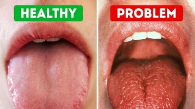 Dry Mouth Solutions: Causes, Treatments, and Prevention Tips