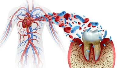 The Link Between Oral Health and Heart Disease: What You Need to Know